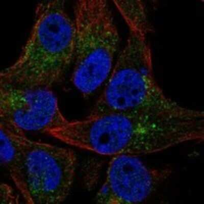 Immunocytochemistry/ Immunofluorescence: VAC14 Antibody [NBP3-17962]