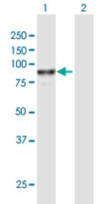 Western Blot: VAC14 Antibody [H00055697-B01P]