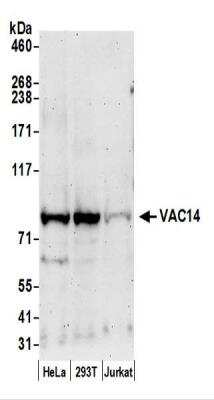 Western Blot: VAC14 Antibody [NBP2-44278]