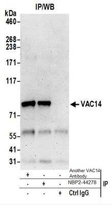 Western Blot: VAC14 Antibody [NBP2-44278]