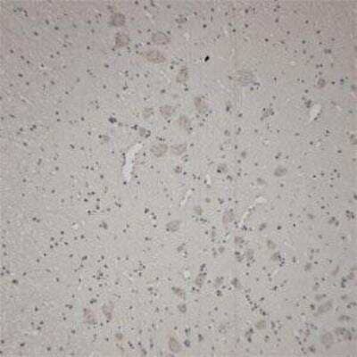 Immunohistochemistry-Paraffin: VAChT/SLC18A3 Antibody [NB100-91348]