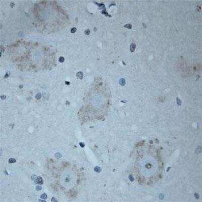 Immunohistochemistry-Paraffin: VAChT/SLC18A3 Antibody [NB100-91348]