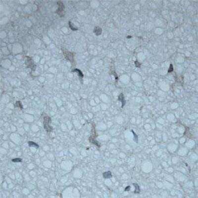 Immunohistochemistry-Paraffin: VAChT/SLC18A3 Antibody [NB100-91348]