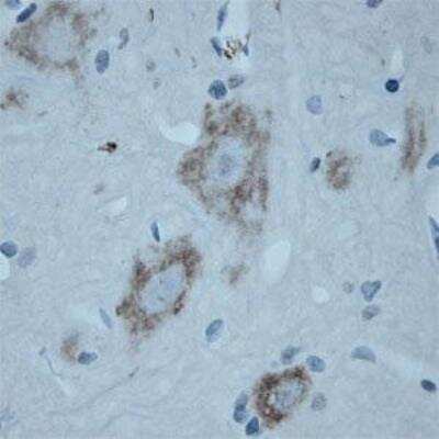 Immunohistochemistry-Paraffin: VAChT/SLC18A3 Antibody [NB100-91348]