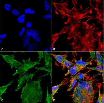 Immunocytochemistry/ Immunofluorescence: VAChT/SLC18A3 Antibody (S6-38) [NBP2-59378]