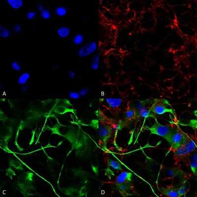 Immunocytochemistry/ Immunofluorescence: VAChT/SLC18A3 Antibody (S6-38) [NBP2-59378]