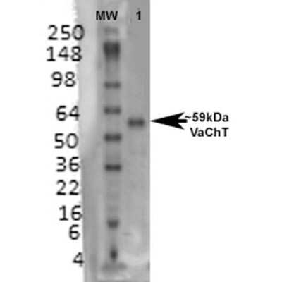 Western Blot: VAChT/SLC18A3 Antibody (S6-38) [NBP2-59378]