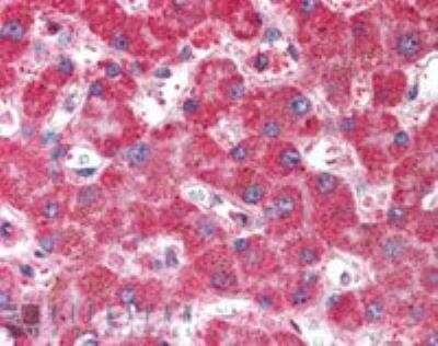 Immunohistochemistry-Paraffin: VAM1 Antibody [NB100-1366]