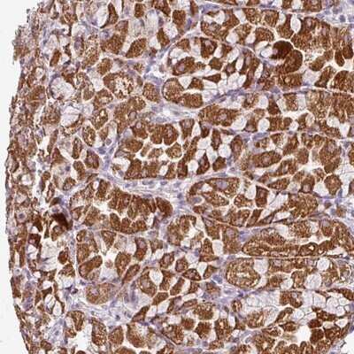 Immunohistochemistry-Paraffin: VAM1 Antibody [NBP1-87364]