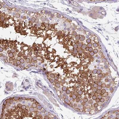 Immunohistochemistry-Paraffin: VAM1 Antibody [NBP1-87365]