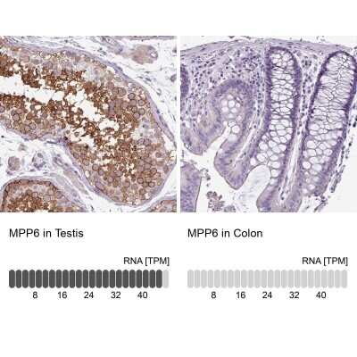 Immunohistochemistry-Paraffin: VAM1 Antibody [NBP1-87365]
