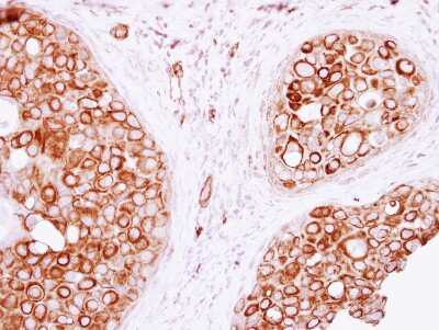 Immunohistochemistry-Paraffin: VAM1 Antibody [NBP2-15158]