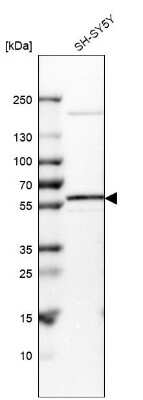 Western Blot: VAM1 Antibody [NBP1-87365]