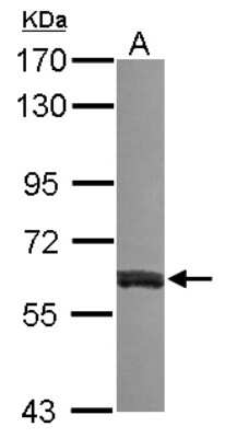 Western Blot: VAM1 Antibody [NBP2-15158]