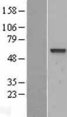 Western Blot: VAM1 Overexpression Lysate [NBL1-13205]