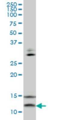 Western Blot: VAMP-1 Antibody (5A4) [H00006843-M02]