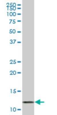 Western Blot: VAMP-1 Antibody (5F3) [H00006843-M01]