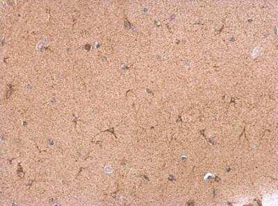 Immunohistochemistry-Paraffin: VAMP-1 Antibody [NBP2-15159]