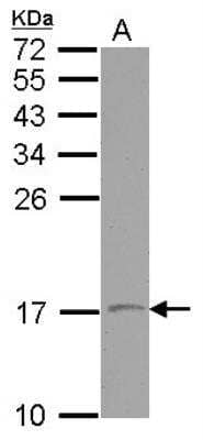 Western Blot: VAMP-1 Antibody [NBP2-15159]