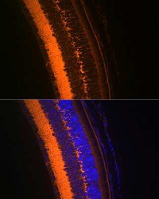 Immunohistochemistry: VAMP-2 Antibody (8X9D9) [NBP3-16362]