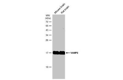 Western Blot: VAMP-2 Antibody (GT6311) [NBP3-13633]