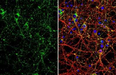 Immunocytochemistry/ Immunofluorescence: VAMP-2 Antibody (GT766) [NBP3-13634]