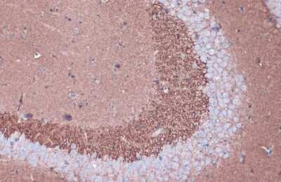 Immunohistochemistry-Paraffin: VAMP-2 Antibody (GT766) [NBP3-13634]