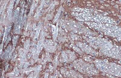 Immunohistochemistry-Paraffin: VAMP-2 Antibody (GT766) [NBP3-13634]