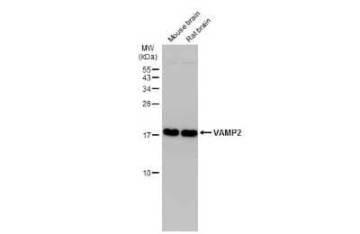 Western Blot: VAMP-2 Antibody (GT766) [NBP3-13634]