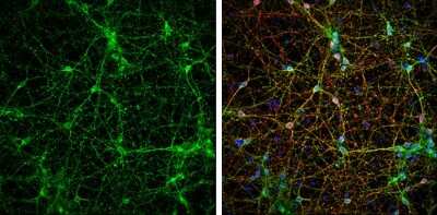 Immunocytochemistry/ Immunofluorescence: VAMP-2 Antibody [NBP3-13179]