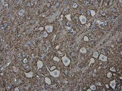 Immunohistochemistry-Paraffin: VAMP-2 Antibody [NBP3-13179]