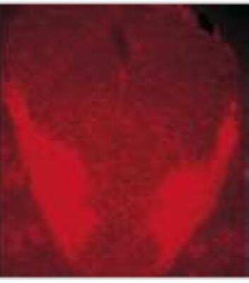 Immunohistochemistry: VAMP-1/VAMP-2 Antibody (SP10) [NBP1-19332]