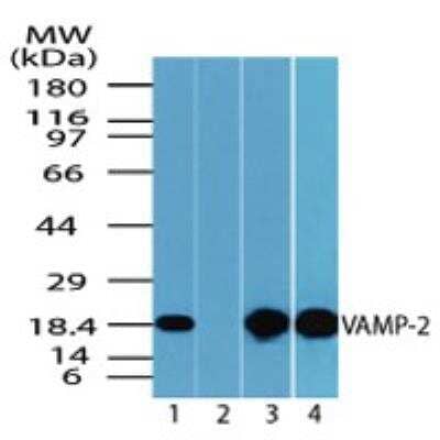 Western Blot: VAMP-2 Antibody [NBP2-24599]