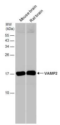 Western Blot: VAMP-2 Antibody [NBP3-13179]