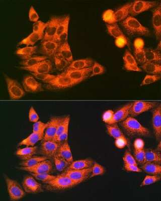 Immunocytochemistry/ Immunofluorescence: VAMP-7 Antibody - Azide and BSA Free [NBP3-15595]