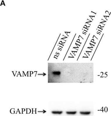 Knockdown Validated: VAMP-7 Antibody [NBP2-32232]