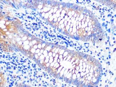 Immunohistochemistry-Paraffin: VAMP-8 Antibody (5H9S4) [NBP3-16471]