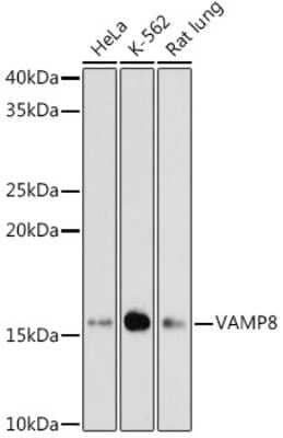 Western Blot: VAMP-8 Antibody (5H9S4) [NBP3-16471]