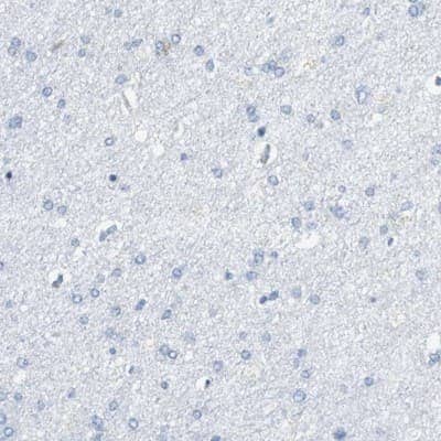Immunohistochemistry-Paraffin: VAMP-8 Antibody [NBP1-84013]
