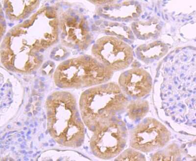 Immunohistochemistry-Paraffin: VAMP-8 Antibody (JF0963) [NBP2-66777]
