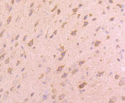 Immunohistochemistry-Paraffin: VAMP-8 Antibody (JF0963) [NBP2-66777]