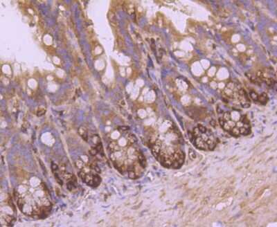 Immunohistochemistry-Paraffin: VAMP-8 Antibody (JF0963) [NBP2-66777]