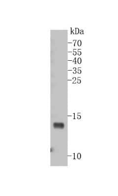 Western Blot: VAMP-8 Antibody (JF0963) [NBP2-66777]