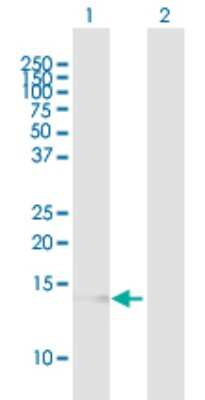 Western Blot: VAMP-8 Antibody [H00008673-B01P]