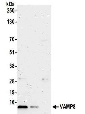 Western Blot: VAMP-8 Antibody [NBP2-32095]