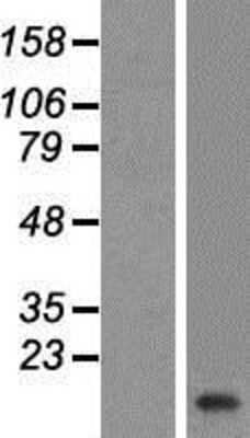 Western Blot: VAMP-2 Overexpression Lysate [NBP2-07371]