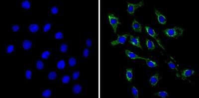 Immunocytochemistry/ Immunofluorescence: VAMP3/Cellubrevin Antibody [NB300-510]