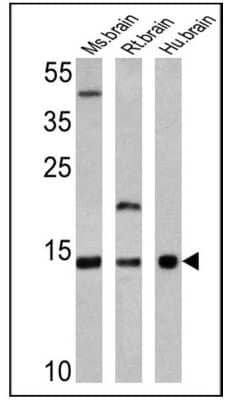 Western Blot: VAMP3/Cellubrevin Antibody [NB300-510]