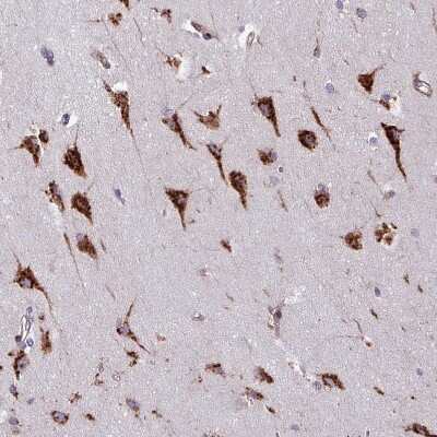 Immunohistochemistry-Paraffin: VAMP4 Antibody [NBP2-13512]