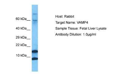 Western Blot: VAMP4 Antibody [NBP2-83746]